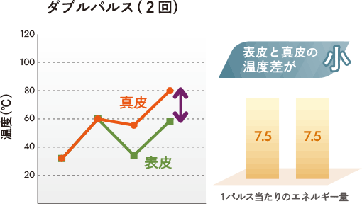 ダブルパルス（2回）表皮と真皮の温度差が小